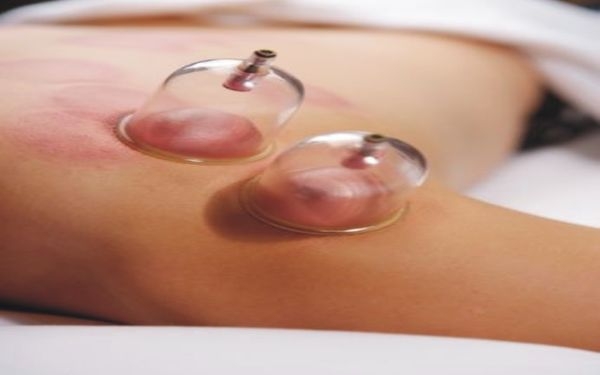 المتخصص ابونور لعلاج الصداع بالحجامة66877755