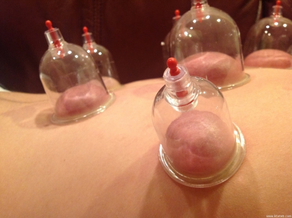 الحجامة ابونور الكويت 66877755